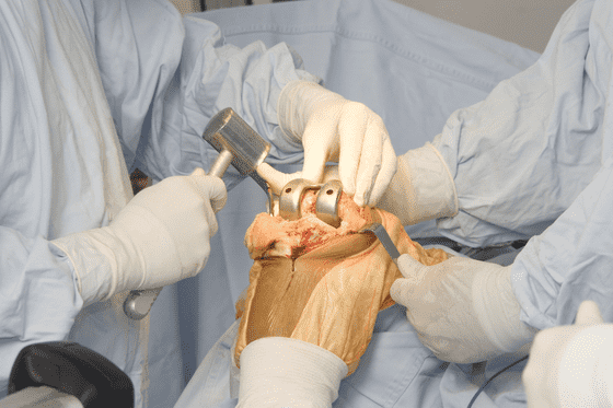 Orthopaedic Surgery